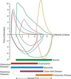 Flow Volume Loops by Disease Type